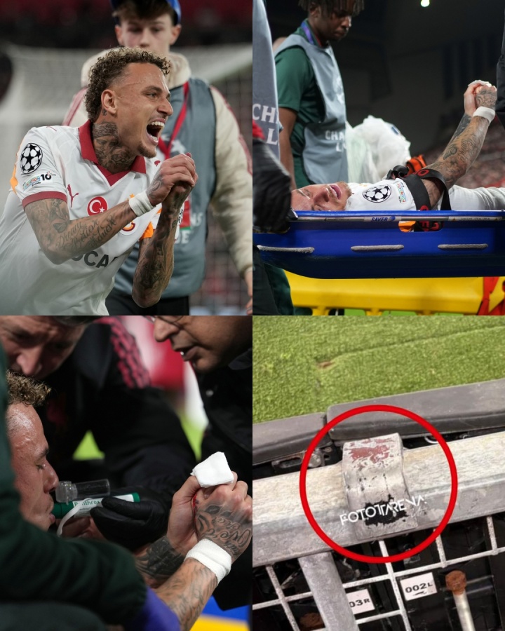 诺阿·朗拇指遭广告牌割裂重伤 术后确认可保住 力争出战世预赛