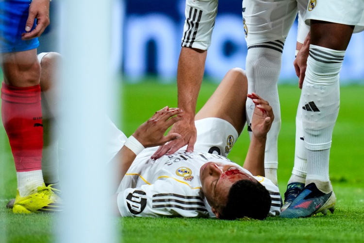 皇马战平赫罗纳联赛两轮不胜 姆巴佩争议倒地未获点球