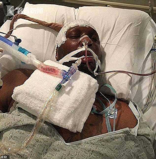 奥多姆首度详述吸毒昏迷细节 12次中风后失语失禁