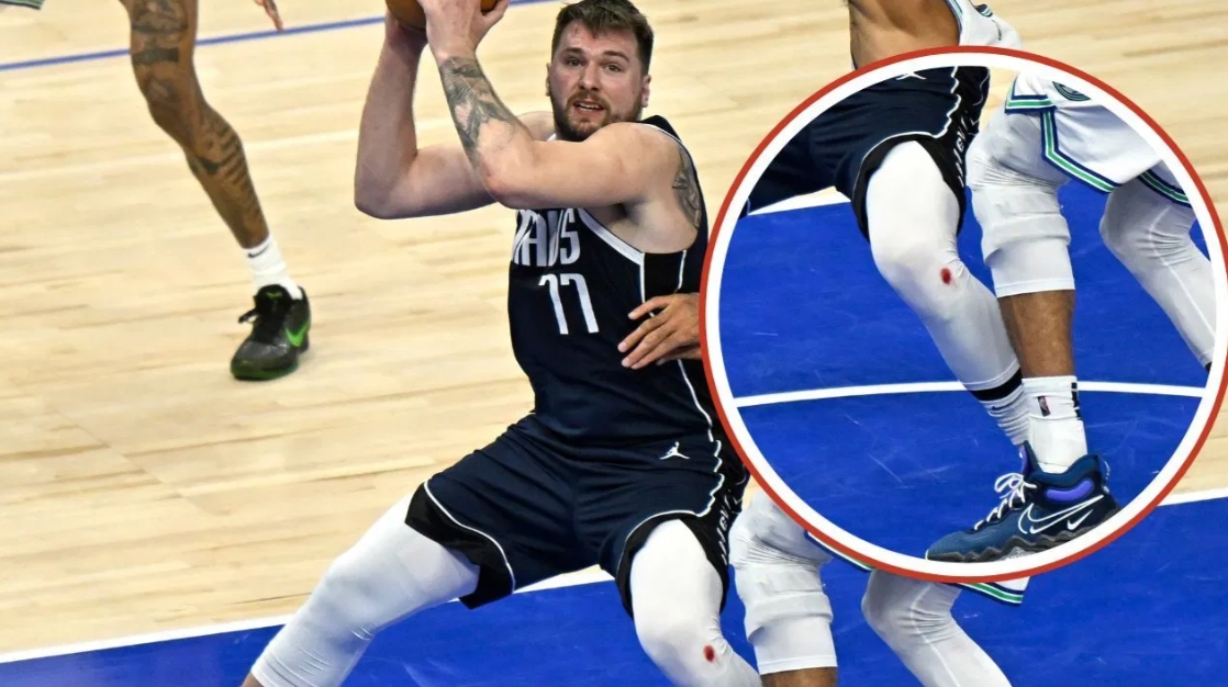 东契奇库里膝盖渗血真相：地板擦伤疤痕撕裂 非药水